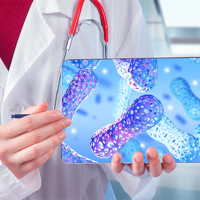 Probióticos en el manejo de dolor en la osteoartritis